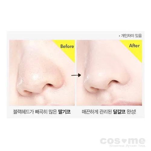Двухшаговая система очищения пор с экстрактом лимона и соды ETUDE HOUSE LEMON SODA BLACKHEAD DUAL KIT — COS ❤️ ME.RU