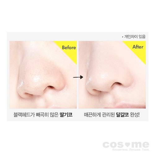 Двухшаговая система очищения пор с экстрактом лимона и соды ETUDE HOUSE LEMON SODA BLACKHEAD DUAL KIT — COS ❤️ ME.RU