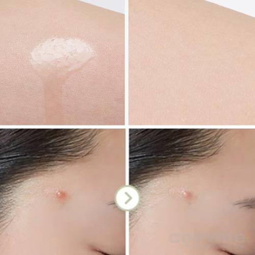 Масло чайного дерева A'PIEU NonCo Tea Tree Oil  — COS ❤️ ME.RU