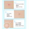 Патчи гидроколлоидные для экстренного лечения прыщей A'PIEU Cica Clear Spot Patch фото 3 — COS ❤️ ME.RU